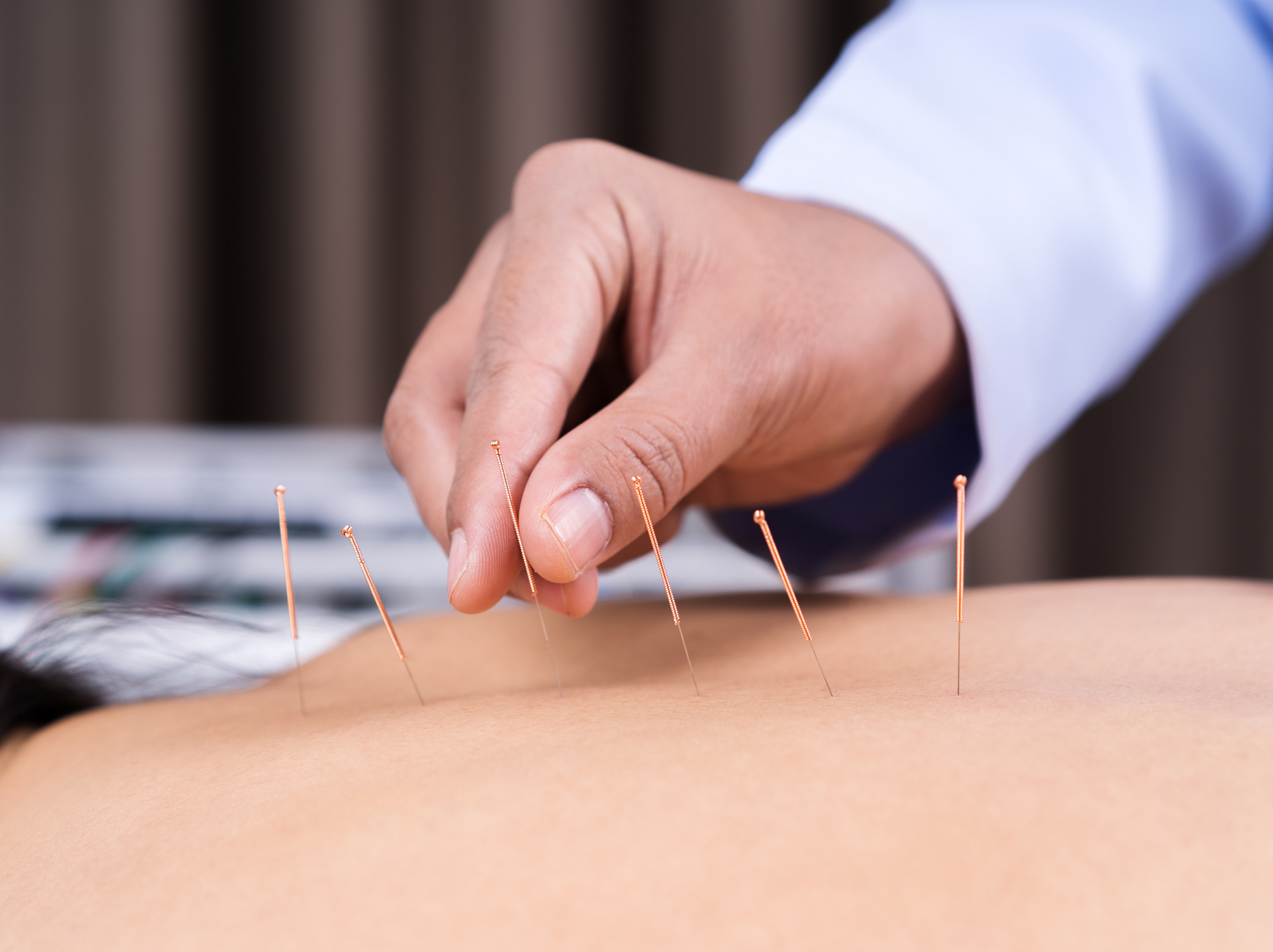 Acupuncture Tung à Bordeaux Sud